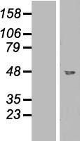 GCD / GCDH Protein - Western validation with an anti-DDK antibody * L: Control HEK293 lysate R: Over-expression lysate