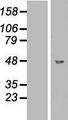 GCD / GCDH Protein - Western validation with an anti-DDK antibody * L: Control HEK293 lysate R: Over-expression lysate