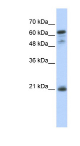 GCET2 / HGAL Antibody - GCET2 antibody Western blot of Transfected 293T cell lysate. This image was taken for the unconjugated form of this product. Other forms have not been tested.