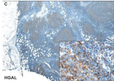 GCET2 / HGAL Antibody - Positive staining of lymph node follicular and interfollicular regions with Anti-HGAL Monoclonal Antibody.