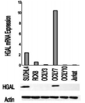 GCET2 / HGAL Antibody - HGAL mRNA and protein expression in lysates of indicated cell lines. Actin served as a loading control.