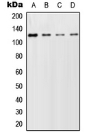 GCFC2 Antibody - Western blot analysis of GCFC2 expression in HeLa (A); SP2/0 (B); PC12 (C) whole cell lysates.