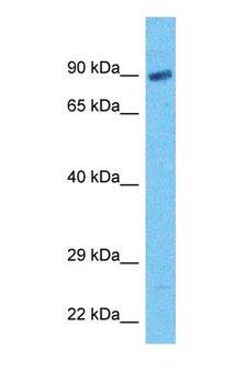 GCFC2 Antibody - Western blot of GCFC2 Antibody with human 293T Whole Cell lysate.  This image was taken for the unconjugated form of this product. Other forms have not been tested.