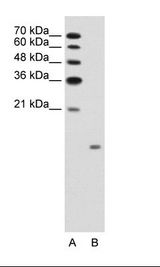 GCG / Glucagon Antibody - A: Marker, B: Jurkat Cell Lysate.  This image was taken for the unconjugated form of this product. Other forms have not been tested.