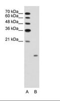 GCG / Glucagon Antibody - A: Marker, B: Jurkat Cell Lysate.  This image was taken for the unconjugated form of this product. Other forms have not been tested.