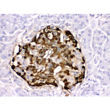 GCG / Glucagon Antibody - GLP1 antibody IHC-paraffin. IHC(P): Human Pancreatic Cancer Tissue.