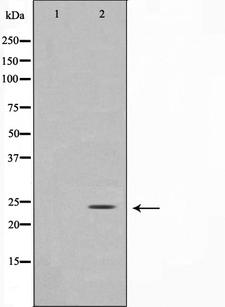 GCG / Glucagon Antibody - Western blot analysis on COS7 cell lysates using Glucagon antibody. The lane on the left is treated with the antigen-specific peptide.