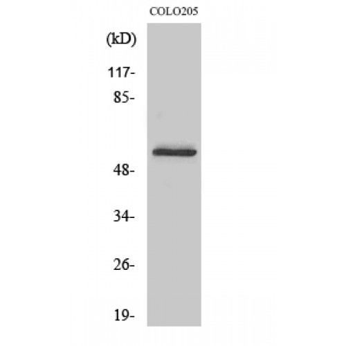 GCGR / Glucagon Receptor Antibody - Western blot of Glucagon Receptor antibody
