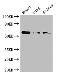 GCGR / Glucagon Receptor Antibody - Positive WB detected in:Mouse heart tissue,Mouse lung tissue,Mouse kidney tissue;All lanes: Gcgr antibody at 3ug/ml;Secondary;Goat polyclonal to rabbit IgG at 1/50000 dilution;Predicted band size: 55 kDa;Observed band size: 55 kDa;