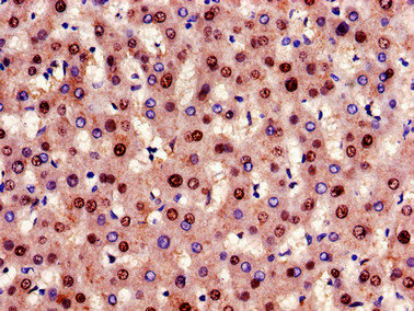 GCGR / Glucagon Receptor Antibody - Immunohistochemistry of paraffin-embedded human liver tissue using GCGR Antibody at dilution of 1:100