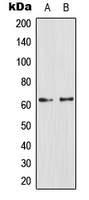 GCGR / Glucagon Receptor Antibody - Western blot analysis of Glucagon Receptor expression in PC12 (A); Jurkat (B) whole cell lysates.