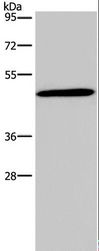 GCGR / Glucagon Receptor Antibody - Western blot analysis of 293T cell, using GCGR Polyclonal Antibody at dilution of 1:200.