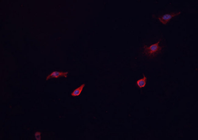 GCGR / Glucagon Receptor Antibody - Staining HeLa cells by IF/ICC. The samples were fixed with PFA and permeabilized in 0.1% Triton X-100, then blocked in 10% serum for 45 min at 25°C. The primary antibody was diluted at 1:200 and incubated with the sample for 1 hour at 37°C. An Alexa Fluor 594 conjugated goat anti-rabbit IgG (H+L) antibody, diluted at 1/600, was used as secondary antibody.