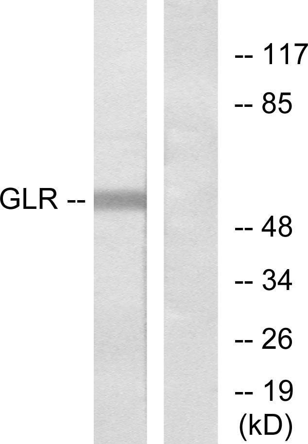 GCGR / Glucagon Receptor Antibody - Western blot analysis of extracts from COLO205 cells, using GLR antibody.