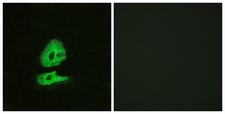 GCGR / Glucagon Receptor Antibody - Peptide - + Immunofluorescence analysis of HeLa cells, using GLR antibody.
