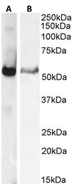 GCGR / Glucagon Receptor Antibody - Anti-Mouse Glucagon receptor staining of rat liver (0.3µg/ml) (A) and human liver (0.001µg/ml) (B) lysates (35µg protein in RIPA buffer). Primary incubation was 1 hour. Detected by chemiluminescence.