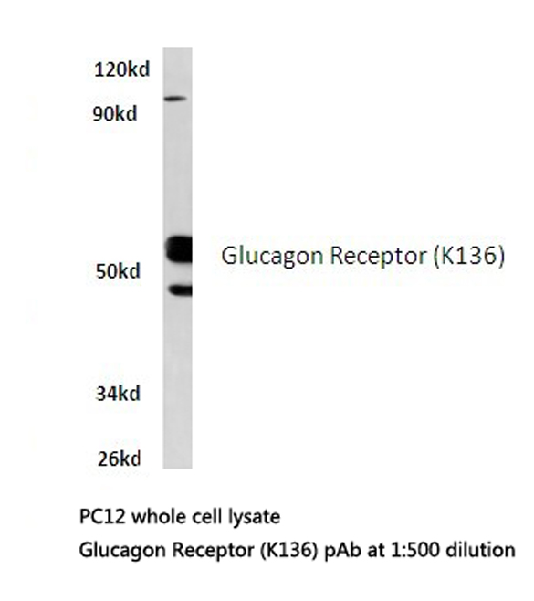 GCGR / Glucagon Receptor Antibody - Western blot of Glucagon Receptor (K136) pAb in extracts from PC12 cells.