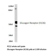 GCGR / Glucagon Receptor Antibody - Western blot of Glucagon Receptor (K136) pAb in extracts from PC12 cells.