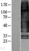 GCGR / Glucagon Receptor Protein - Western validation with an anti-DDK antibody * L: Control HEK293 lysate R: Over-expression lysate