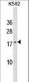 GCHFR Antibody - GCHFR Antibody western blot of K562 cell line lysates (35 ug/lane). The GCHFR antibody detected the GCHFR protein (arrow).