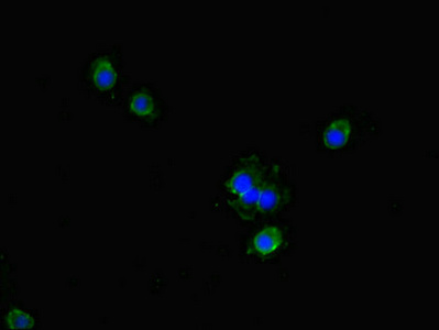 GCHFR Antibody - Immunofluorescent analysis of HeLa cells diluted at 1:100 and Alexa Fluor 488-congugated AffiniPure Goat Anti-Rabbit IgG(H+L)