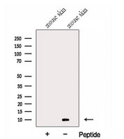 GCHFR Antibody - Western blot analysis of extracts of mouse skin tissue using GCHFR antibody. The lane on the left was treated with blocking peptide.