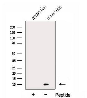 GCHFR Antibody - Western blot analysis of extracts of mouse skin tissue using GCHFR antibody. The lane on the left was treated with blocking peptide.