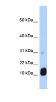GCHFR Antibody - GCHFR antibody Western blot of Fetal Liver lysate. This image was taken for the unconjugated form of this product. Other forms have not been tested.