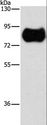 GCK / Germinal Center Kinase Antibody - Western blot analysis of Human fetal brain tissue, using MAP4K2 Polyclonal Antibody at dilution of 1:900.