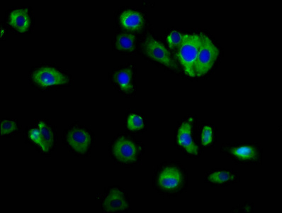 GCK / Germinal Center Kinase Antibody - Immunofluorescence staining of HepG2 cells diluted at 1:166, counter-stained with DAPI. The cells were fixed in 4% formaldehyde, permeabilized using 0.2% Triton X-100 and blocked in 10% normal Goat Serum. The cells were then incubated with the antibody overnight at 4°C.The Secondary antibody was Alexa Fluor 488-congugated AffiniPure Goat Anti-Rabbit IgG (H+L).
