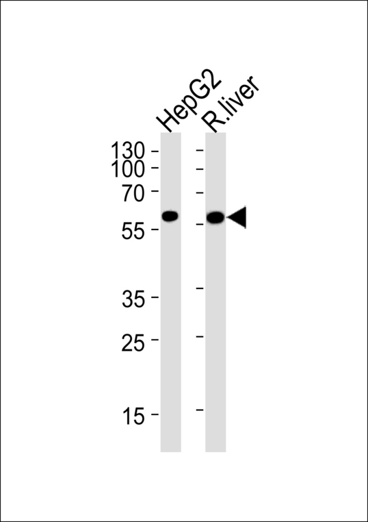 GCK / Glucokinase Antibody - GCK Antibody (M1) western blot of HepG2 cell line and rat liver lysates (35 ug/lane). The GCK antibody detected the GCK protein (arrow).