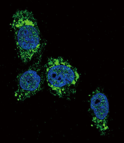 GCK / Glucokinase Antibody - Confocal immunofluorescence of GCK Antibody with HepG2 cell followed by Alexa Fluor 488-conjugated goat anti-rabbit lgG (green). DAPI was used to stain the cell nuclear (blue).
