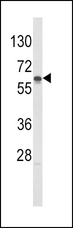 GCK / Glucokinase Antibody - Western blot of hGCK-S418 in Jurkat cell line lysates (35 ug/lane). GCK (arrow) was detected using the purified antibody.
