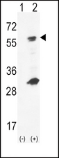 GCK / Glucokinase Antibody - Western blot of GCK (arrow) using rabbit polyclonal hGCK-S418. 293 cell lysates (2 ug/lane) either nontransfected (Lane 1) or transiently transfected (Lane 2) with the GCK gene.