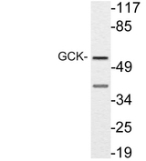 GCK / Glucokinase Antibody - Western blot analysis of lysate from NIH/3T3 cells, using GCK antibody.