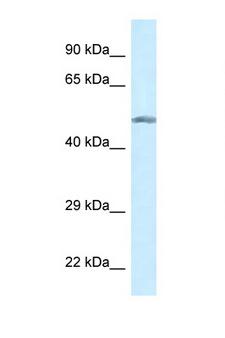 GCK / Glucokinase Antibody - GCK / Glucokinase antibody Western blot of COL0205 Cell lysate. Antibody concentration 1 ug/ml.  This image was taken for the unconjugated form of this product. Other forms have not been tested.