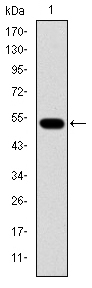 GCK / Glucokinase Antibody - Western blot using GCK monoclonal antibody against human GCK (AA: 1-198) recombinant protein. (Expected MW is 48.2 kDa)