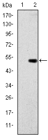 GCK / Glucokinase Antibody - Western blot using GCK monoclonal antibody against HEK293 (1) and GCK-hIgGFc transfected HEK293 (2) cell lysate.