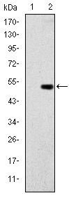 GCK / Glucokinase Antibody - GCK Antibody in Western Blot (WB)