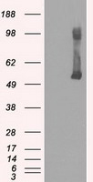 GCK / Glucokinase Antibody - HEK293T cells were transfected with the pCMV6-ENTRY control (Left lane) or pCMV6-ENTRY GCK (Right lane) cDNA for 48 hrs and lysed. Equivalent amounts of cell lysates (5 ug per lane) were separated by SDS-PAGE and immunoblotted with anti-GCK.