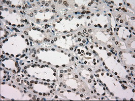 GCK / Glucokinase Antibody - IHC of paraffin-embedded Kidney tissue using anti-GCK mouse monoclonal antibody. (Dilution 1:50).