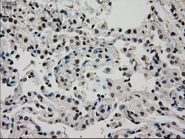 GCK / Glucokinase Antibody - IHC of paraffin-embedded lung tissue using anti-GCK mouse monoclonal antibody. (Dilution 1:50).