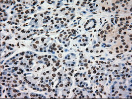 GCK / Glucokinase Antibody - IHC of paraffin-embedded pancreas tissue using anti-GCK mouse monoclonal antibody. (Dilution 1:50).