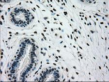 GCK / Glucokinase Antibody - IHC of paraffin-embedded breast tissue using anti-GCK mouse monoclonal antibody. (Dilution 1:50).