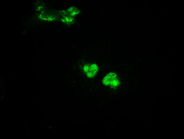 GCK / Glucokinase Antibody - Anti-GCK mouse monoclonal antibody  immunofluorescent staining of COS7 cells transiently transfected by pCMV6-ENTRY GCK.