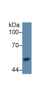 GCK / Glucokinase Antibody - Western Blot; Sample: Rat Liver lysate; Primary Ab: 1µg/ml Rabbit Anti-Rat GCK Antibody Second Ab: 0.2µg/mL HRP-Linked Caprine Anti-Rabbit IgG Polyclonal Antibody