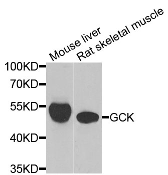GCK / Glucokinase Antibody - Western blot analysis of extracts of various cells.