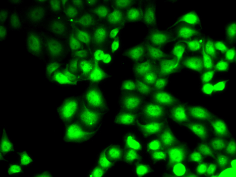 GCK / Glucokinase Antibody - Immunofluorescence analysis of HeLa cells.