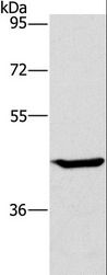 GCK / Glucokinase Antibody - Western blot analysis of HT-29 cell, using GCK Polyclonal Antibody at dilution of 1:450.