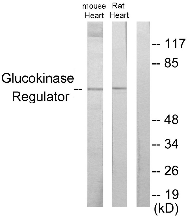 GCKR Antibody - Western blot analysis of lysates from mouse heart and rat heart cells, using Glucokinase Regulator Antibody. The lane on the right is blocked with the synthesized peptide.